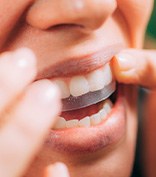 Closeup of someone placing whitening strip over upper arch
