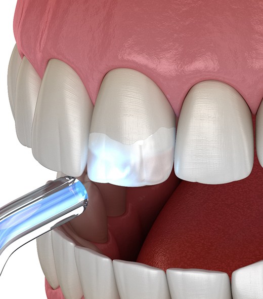Dentist talking to female patient about candidacy