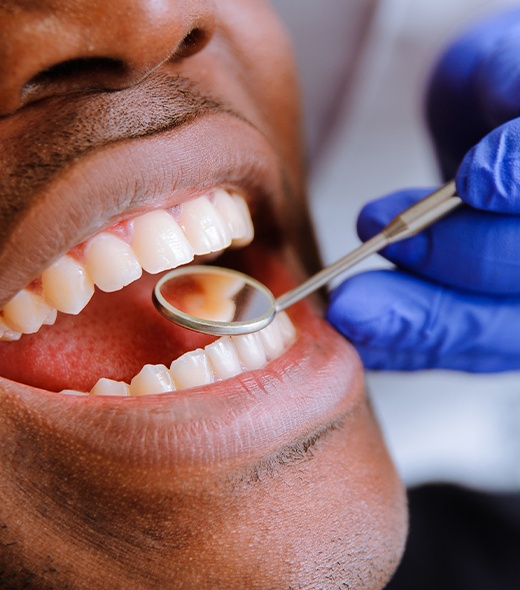 Dentist checking patient's smile after tooth colored filling treatment