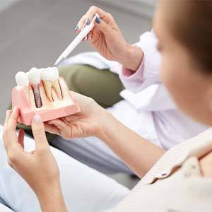 Dentist showing woman model of a dental implant