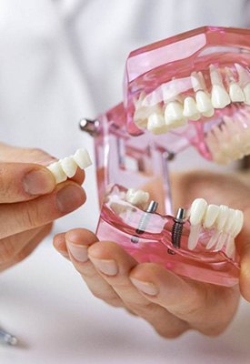 Hands holding model teeth and sample implant bridge