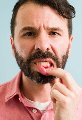 Man pulling down lower lip to reveal dark red gums