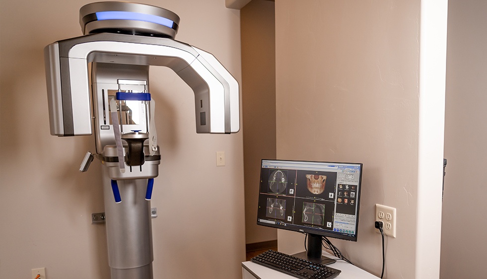 3 D C T cone beam x-ray scanner