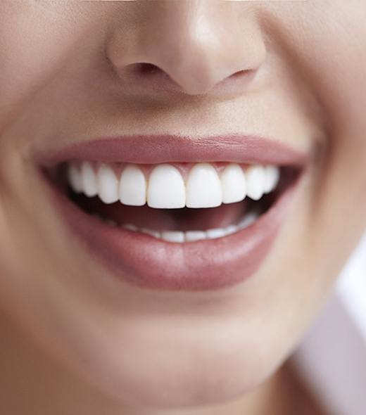 Closeup of healthy smile after fluoride treatment