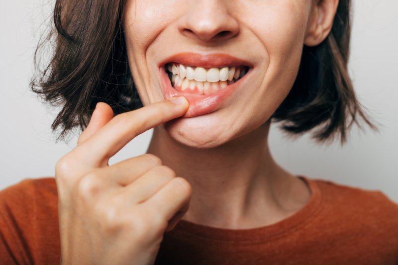 Woman shows her gums